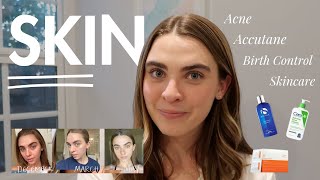 How I Cleared My Skin  Hormonal Acne Accutane Cystic Acne amp more [upl. by Garda214]