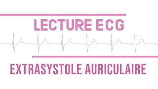 Interprétation ECG  Extrasystole Auriculaire quotESAquot [upl. by Garwin68]