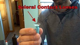 Scleral Lenses after Laser Eye Surgery [upl. by Tania]