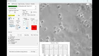 AF D Low Density at 40x [upl. by Ayik]