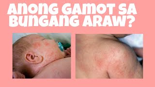 ANONG GAMOT SA BUNGANG ARAW NI BABY  MOMMY JAEN [upl. by Meer]