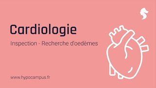 Recherche doedèmes  Inspection de Cardiologie [upl. by Ryley]