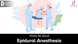 Epidural Anesthesia for Labor  Pros amp Cons DrNanda Kumar M of Cloudnine HospitalsDoctors Circle [upl. by Renrut834]