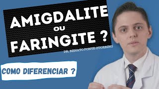 Faringite ou Amigdalite Saiba as principais diferenças  Dr Renato Ponte Otorrino [upl. by Winsor]