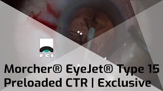 Morcher® EyeJet® Type 15 CTR  Preloaded CTR with extra curve  Procedure  Exclusive  FCI Cataract [upl. by Nerrat732]