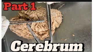 Gyri and sulci of cerebrum part 1 mbbsanatomy nepalforyou viral medicalhacks [upl. by Airotcivairam]