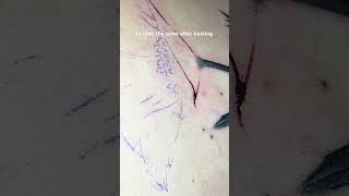 Tattoo Skin Depth Tips [upl. by Lehet220]