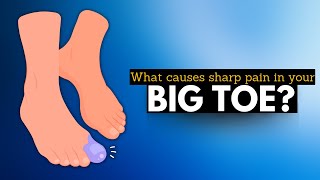 Big Toe Pain Unmasking the Culprits Behind Sharp Aches [upl. by Eyde]