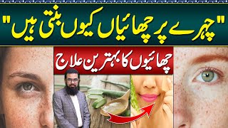 Melasma Treatment at Home  Melasma Cream and Melasma Home Remedies  Face Par Chaiyan Ka Ilaj [upl. by Lim]