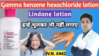 Lindane lotion usp  Lindane lotion  Scaboma lotion  Scaboma lotion for scabies [upl. by Irolav399]