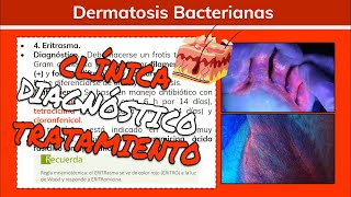 ⚕️🩺 Dermatosis Bacterianas PÚSTULA MALIGNA RINOESCLEROMA ERITRASMA  Dermatología [upl. by Charbonnier]