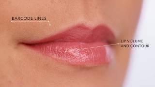 Fillerina Specific Zones with 3D Collagen [upl. by Aisayt]