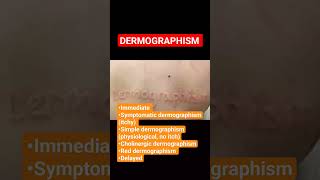 Dermographism dermographism dermatology skincare neetpgcosmotology urticaria hypersensitivity [upl. by Elysha486]