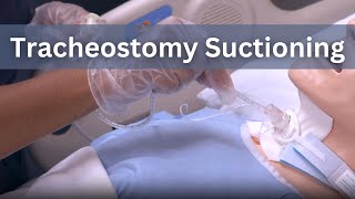 Tracheostomy Suctioning [upl. by Giorgi]