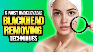 5 Unbelievable Blackhead Removal Techniques You Need to Try ASAP [upl. by Bentlee]