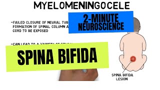 2Minute Neuroscience Spina Bifida [upl. by Adnilim]