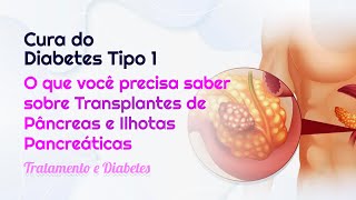 Cura do Diabetes Tipo 1 Entenda tudo sobre Transplante de Pâncreas e Ilhotas Pancreáticas [upl. by Nawat]