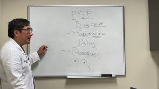 Downgaze and upgaze paresis in progressive supranuclear palsy PSP [upl. by Pitt990]