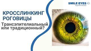 Трансэпителиальный или традиционный кросслинкинг при кератоконусе  что лучше [upl. by Kalb]