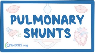 Pulmonary shunts [upl. by Nylitsirk]