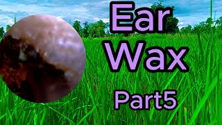 ear wax removal asmr [upl. by Anelegna]