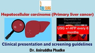 Hepatocellular carcinoma Primary liver cancer  Symptoms amp signs  screening how to detect early [upl. by Ikcaj]