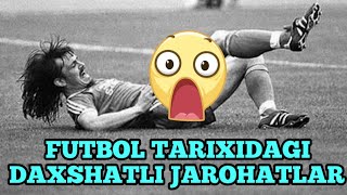 HAMMA KORSIN FAQAT YURAGI BOSHLAR KORMASIN FUTBOL TARIXIDAGI ENG DAXSHATLI JAROXATLAR [upl. by Animaj]