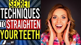 How to Straighten Your Teeth at Home Without Braces Hidden Secret Techniques [upl. by Timoteo]