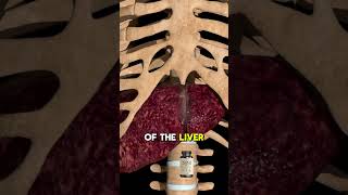 TUDCA Fatty Liver and Gallbladder Remedy  Revealed by Dr Berg [upl. by Lionel645]