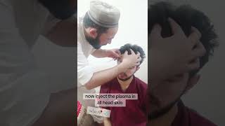 How to done PRP  PRP process with izhar salar PRP mefical treanding treatment college [upl. by Fedora]