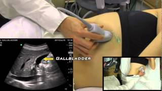 Gallbladder Ultrasound from One Minute Ultrasound [upl. by Atsirt]