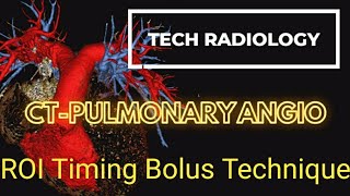 PULMONARY ANGIOGRAPHY CTPRESSURE INJECTING CONTRASTROITIME BOLUS😍 [upl. by Lenehc]