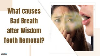 What causes Bad Breath after Wisdom Teeth Removal How to treat Dental Live Chat Dr Vadivel DDS [upl. by Hamo]