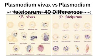 Plasmodium vivax vs Plasmodium falciparum 40 Differences [upl. by Spiro937]