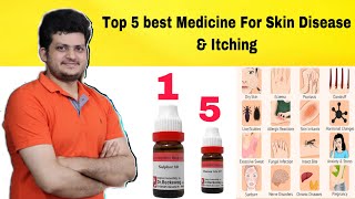 Top 5 Homeopathic Medicine for Itching amp Skin Diseases [upl. by Cavil]