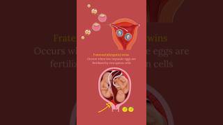 How Identical and Fraternal Twins Are Formed  twins fraternaltwins [upl. by Spieler]