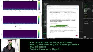 Biomedical Data Tools Live Development HMS  Harmful Brain Activity Classification [upl. by Hoppe851]