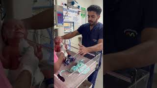 NEBULIZATION NEWBORN BABY IN NICU Ankur maitrika hospital 🏥 [upl. by Tillinger686]