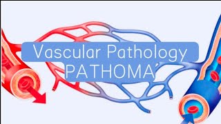 Vascular PATHOMA 3  Hypertension [upl. by Amund]