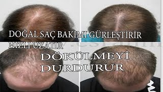 SAÇIN SEYREKSE BUNU UYGULA100 DOĞAL ÇÖZÜM ŞAKA DEGİL GÜZELLİK BAKIM [upl. by Uy]