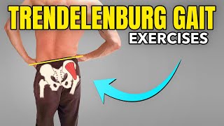 3 Exercises to Correct a Trendelenburg Gait Pattern [upl. by Semaj]