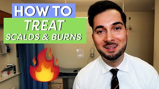 Burns  How To Treat Burns  How To Treat A Burn [upl. by Chiaki]