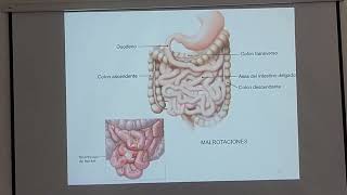 CLASE PERITONEO SISTEMA VASCULAR [upl. by Ylrad]