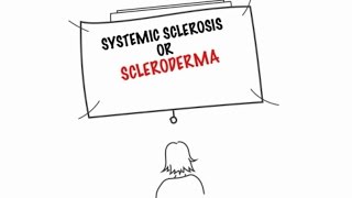 Understanding Systemic Sclerosis [upl. by Icaj]