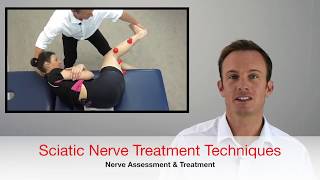 Sciatic Nerve Treatment Techniques [upl. by Ylime140]