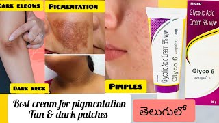 GLYCO 6 Cream review in telugu How to use Glycolic acidGlycolic acid cream [upl. by Keary]