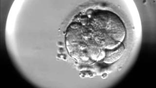 Timelapse of fertilisation of a human egg under the microscope [upl. by Ainel]