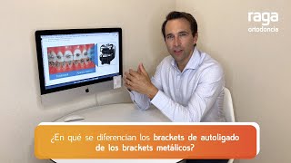 Brackets de AUTOLIGADO vs convencionales ✔ ¿Qué VENTAJAS tienen [upl. by Dnarb]