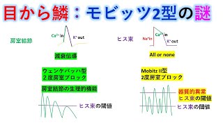 心電図 暗記からの卒業 134話 2度房室ブロックの分岐点 [upl. by Rudolph]