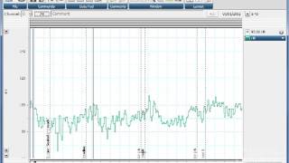 Automatically find a point and select Data in LabChart [upl. by Selia370]